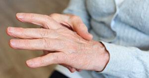 durere severă din cauza artritei